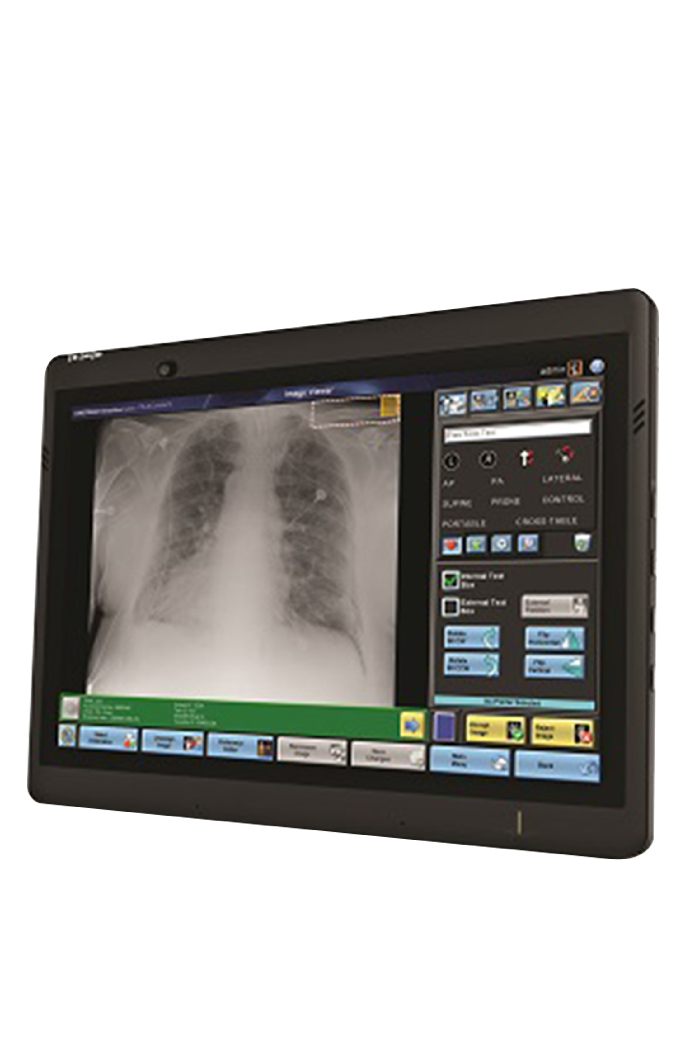 CARESTREAM DRX TRANSPORTABLE